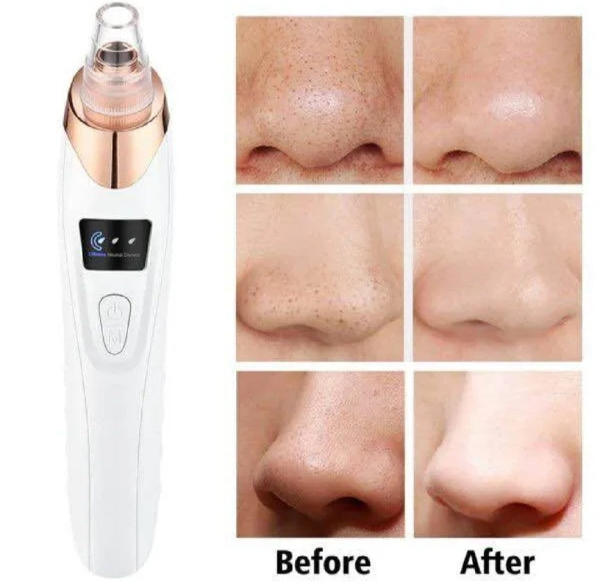 5-in-1 Electric Blackhead Remover Pore Vacuum