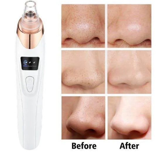 5-in-1 Electric Blackhead Remover Pore Vacuum