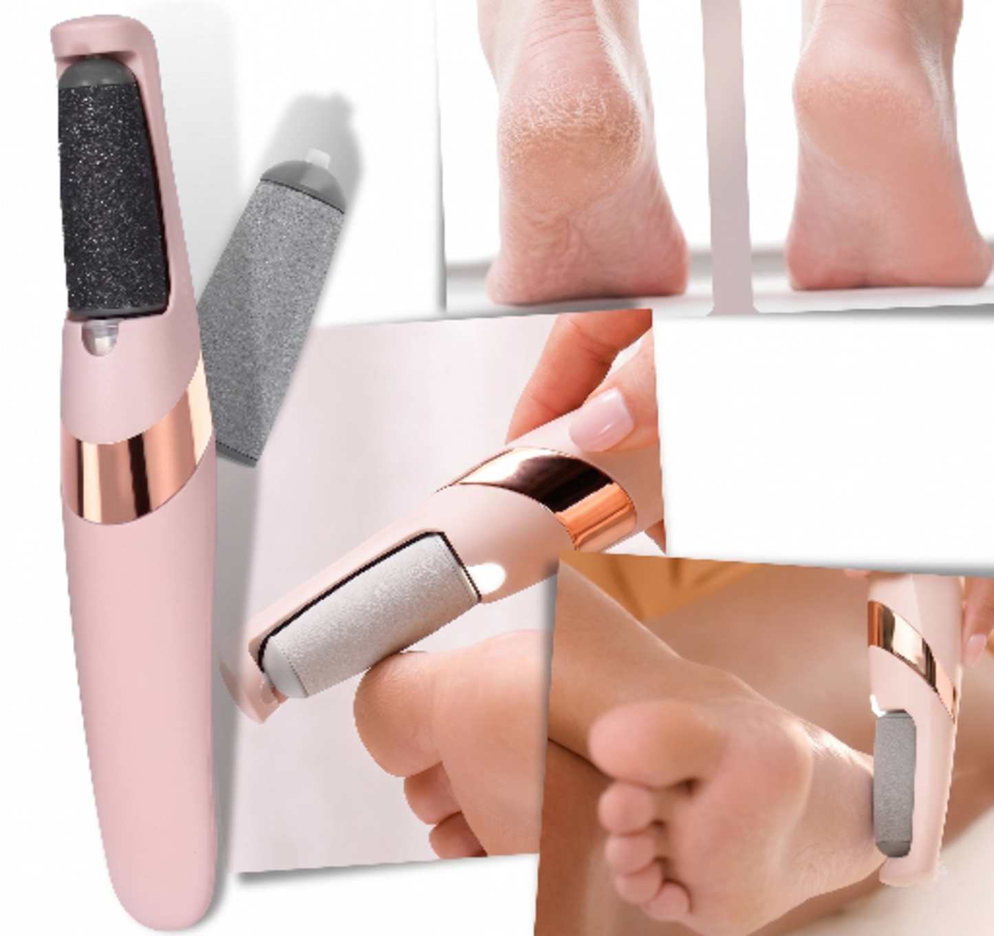 Callus Remover for Feet – Professional Foot File